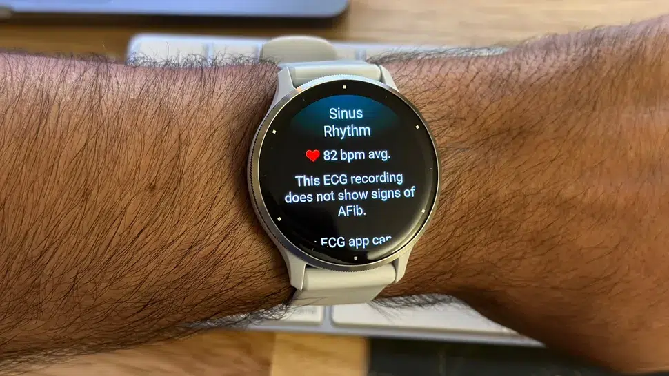 Наиболее вероятные функции Garmin Venu 