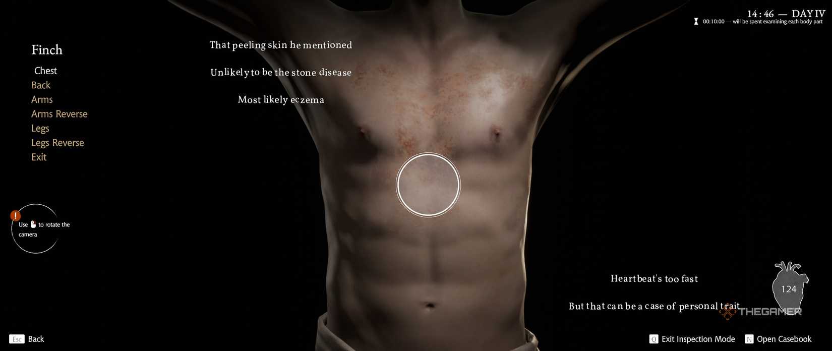 Как диагностировать пациентов в Pathologic 3 пошаговый гайд