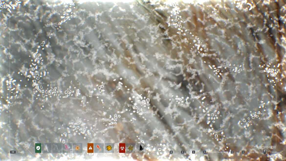 Матиоскоп автофокус Матиоскоп с автофокусом в Quarantine Zone